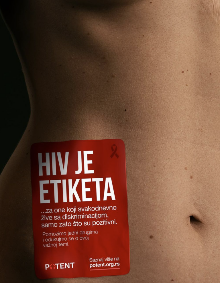 HIV je etiketa…